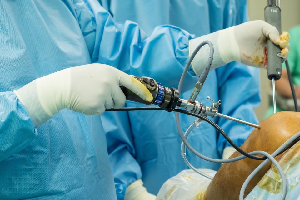 Arthroscopie