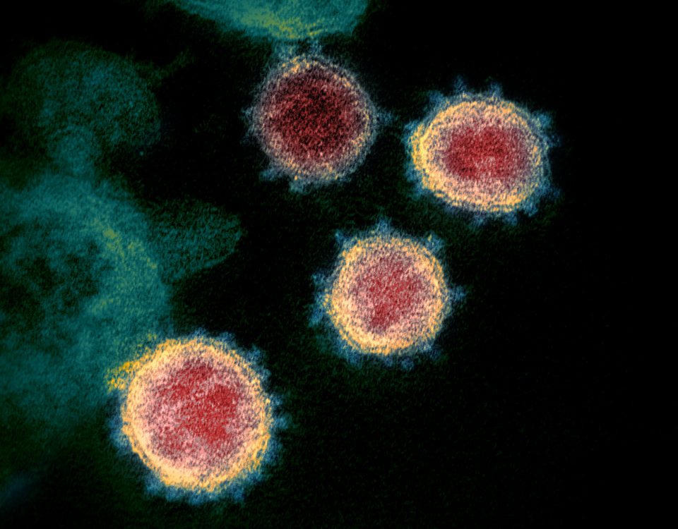 Syndrome respiratoire aigu sévère