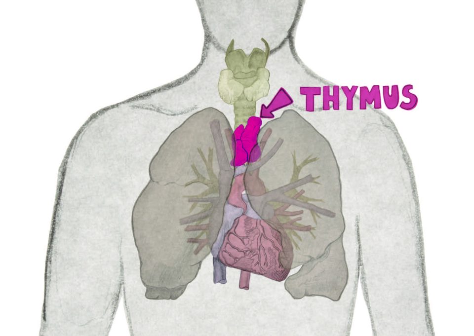 Cancer du thymus