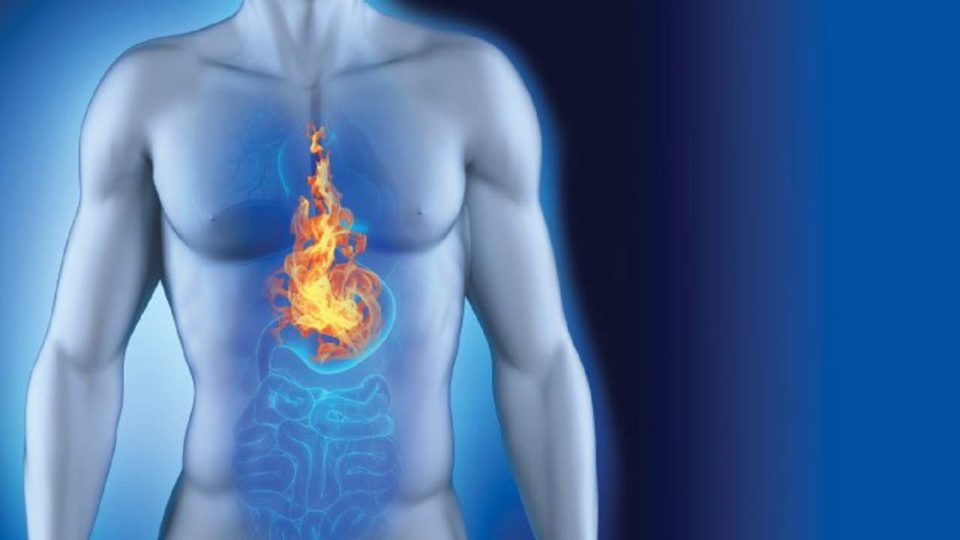 Œsophage de Barrett et reflux acide