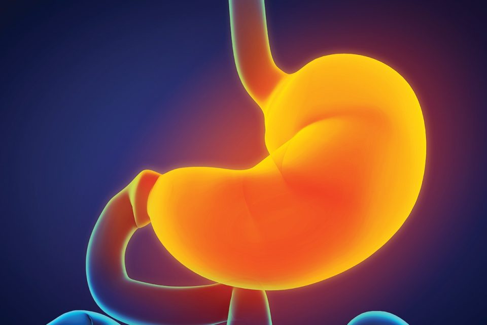 reflux acide