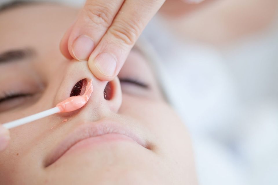 Epilation des narines